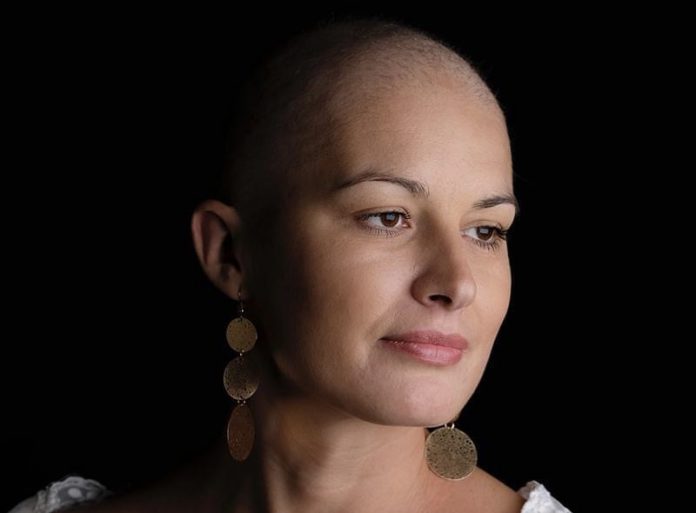 F7FCAF34 D093 4F36 B6FA 22AEBC5AB18D