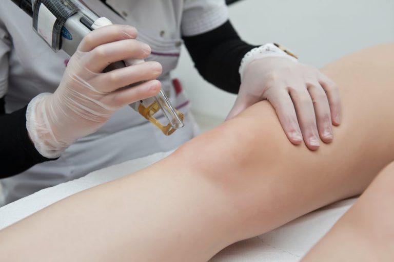 Gdzie jest najlepsza depilacja laserowa w Gliwicach?
