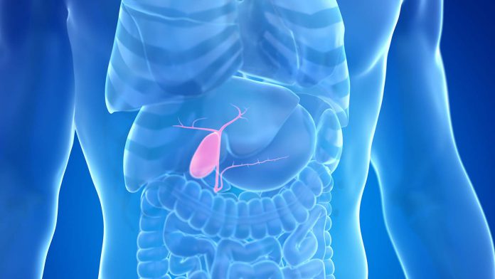 Atak pecherzyka zolciowego jak go rozpoznac i jak leczyc kamienie zolciowe