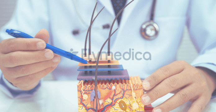 Transplantacja włosów - czym jest i jak działa?